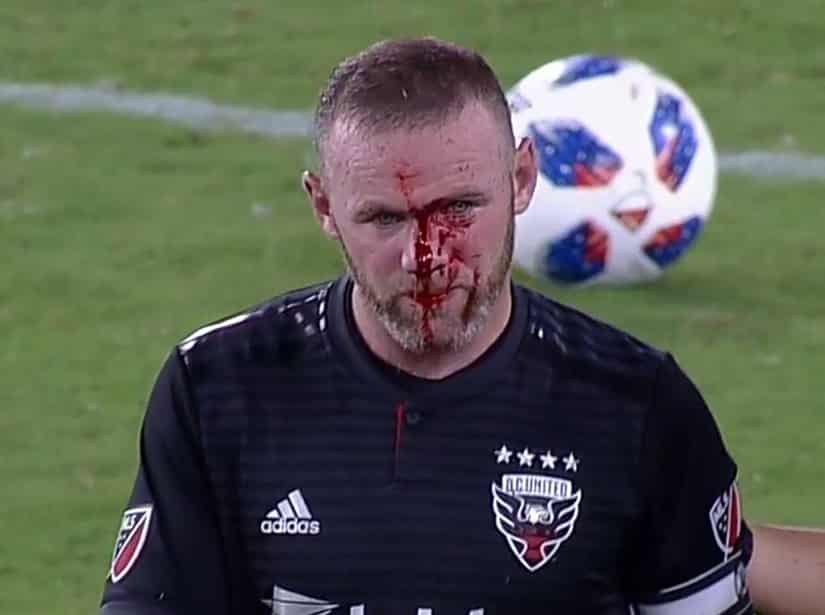 Rooney broken nose DC United