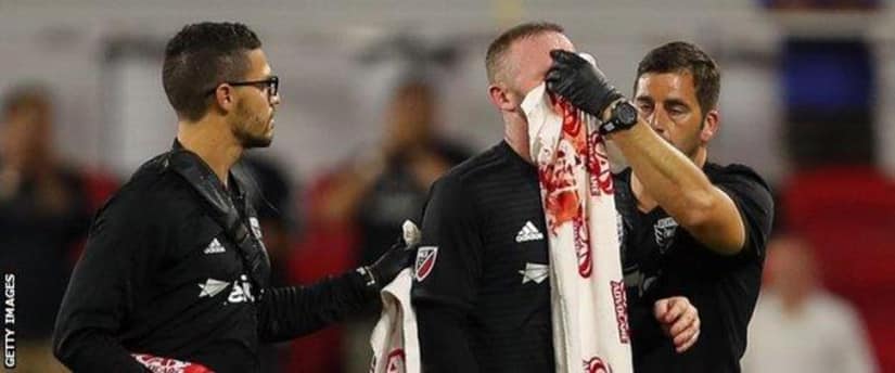Wayne Rooney scores first DC United goal and got broken nose